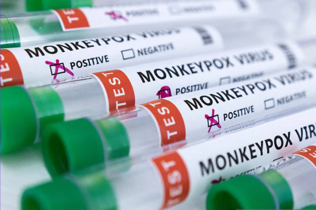 Dinas Kesehatan DKI Bagikan Tiga Langkah Cegah Wabah Cacar Monyet