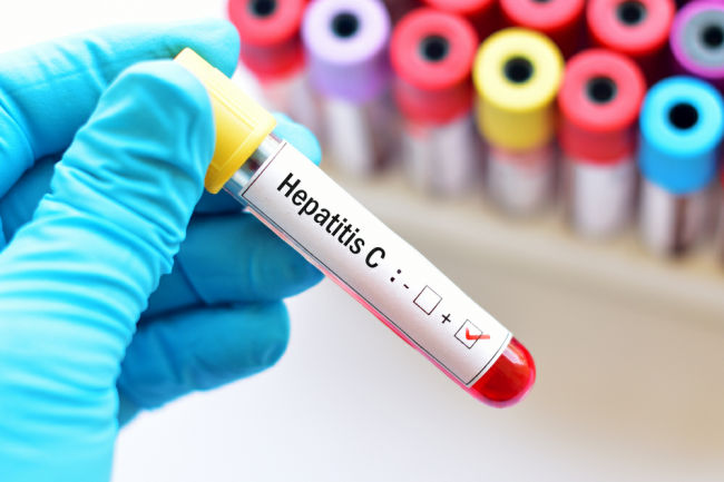 Hepatitis menular melalui