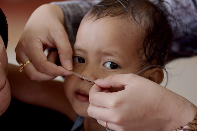 Belum Ada Data Kasus Pneumonia Mycoplasma Anak di Indonesia, IDAI Minta Jangan Ada Kepanikan Masyara