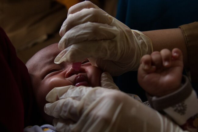 Pentingnya Vaksinasi, Bahaya Polio bagi Anak Bisa Sebabkan Kelumpuhan