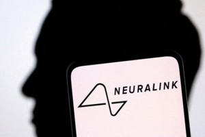 Pasien Manusia Pertama Neuralink Sembuh, Musk: Mampu Kendalikan Mouse Komputer